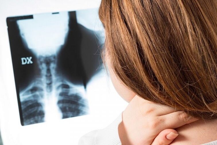 X -Ray من منطقة عنق الرحم